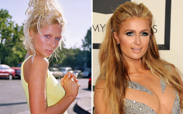 Paris Hilton. Photos hot in a swimsuit, before and after plastic surgery, figure, biography