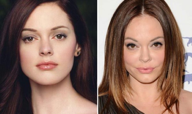 Rose McGowan. Photos leaked, before and after the accident, stolen, biography, personal life