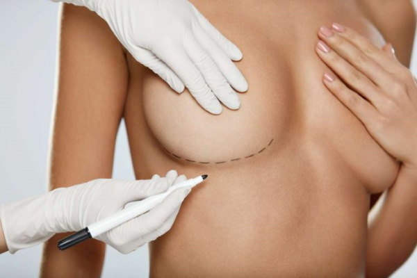 Tubular form of mammary glands, breasts. Photo, correction without surgery for women, men