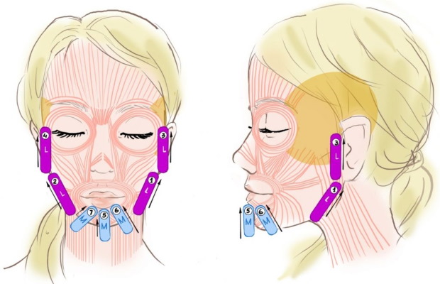 How to remove a double chin. Cosmetology without surgery: injections, threads, fillers, exercises, revitonics, rf lifting, lipolytics, Darsonval, teips and more