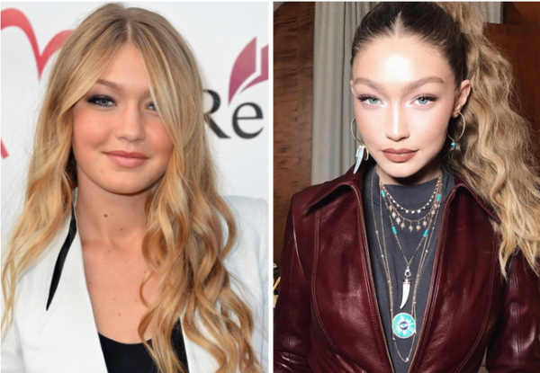 Gigi Hadid. Foto in costume da bagno, prima e dopo la chirurgia plastica, perdita di peso