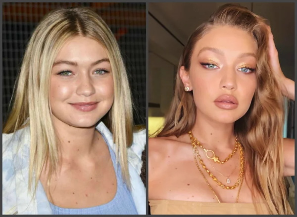 Gigi Hadid. Foto in costume da bagno, prima e dopo la chirurgia plastica, perdita di peso