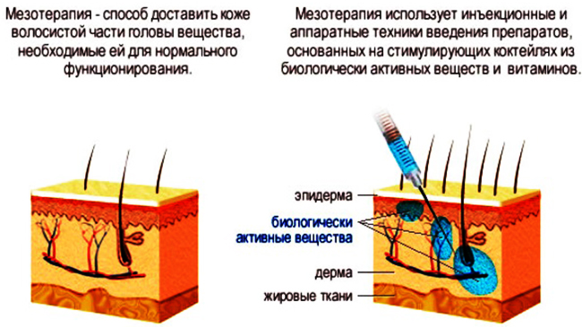 How to get rid of wrinkles under the eyes. Cosmetology