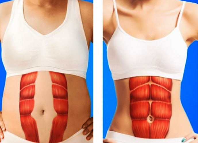 Transverse abdominal muscle. Anatomy, function, abs workout