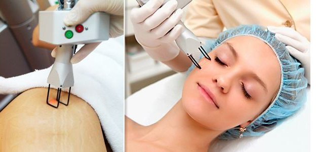 Laser scar removal on the face. Reviews, before and after photos, price