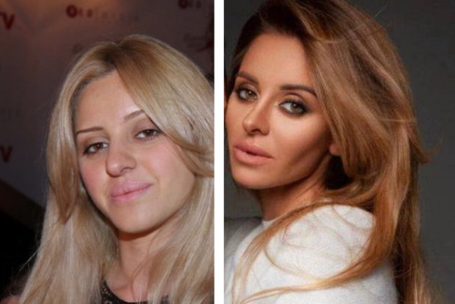 Angelica Revva (Revva's wife) before and after plastic surgery. Photo without photoshop