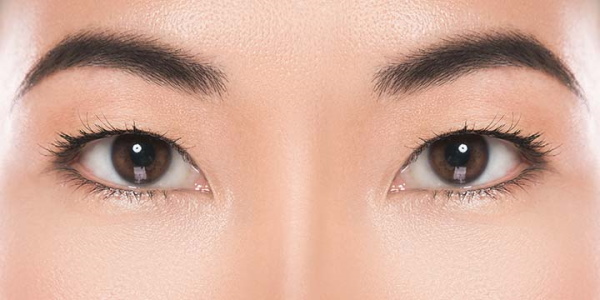 Girls have small eyes. How to increase the price of plastic surgery