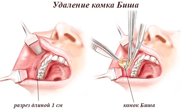 Cheekbones are where on the face, photo, anatomy, how to make