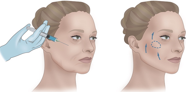 Cheekbones are where on the face, photo, anatomy, how to make