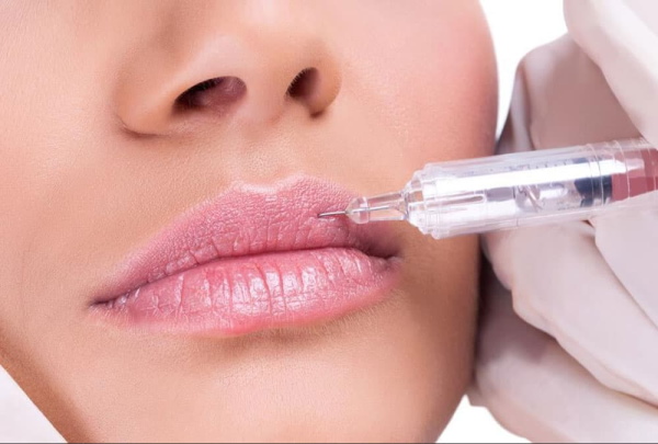 Girls have thin lips. How to increase with hyaluronic acid, filler, botox