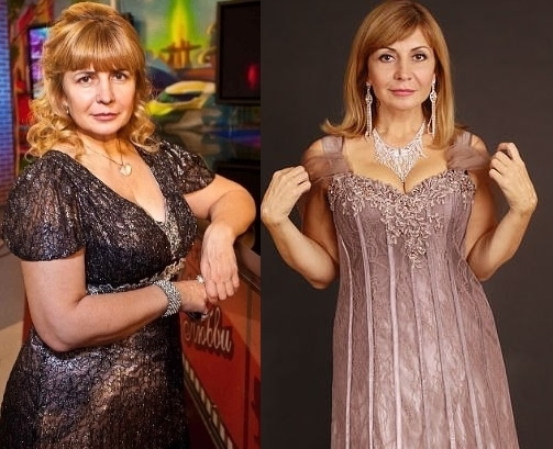 Irina Agibalova. Foto prima e dopo l'intervento chirurgico, perdita di peso