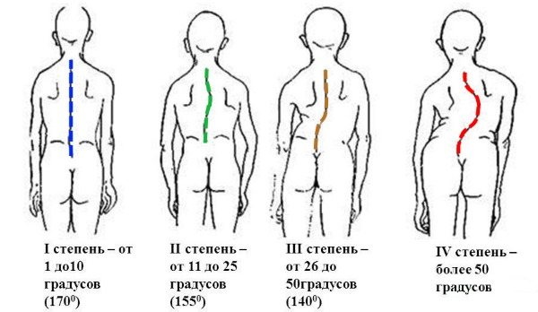 How to reduce the shoulders and back of a girl. Exercise at home